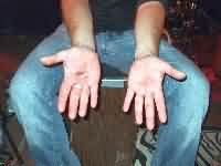 Schm&ouml;lzer Blues Tage